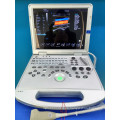 Windows 7 plataforma 4D color doppler portátil escáner de ultrasonido y 3D Doppler escáner